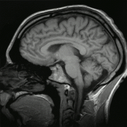 Computational models for Diffusion MRI