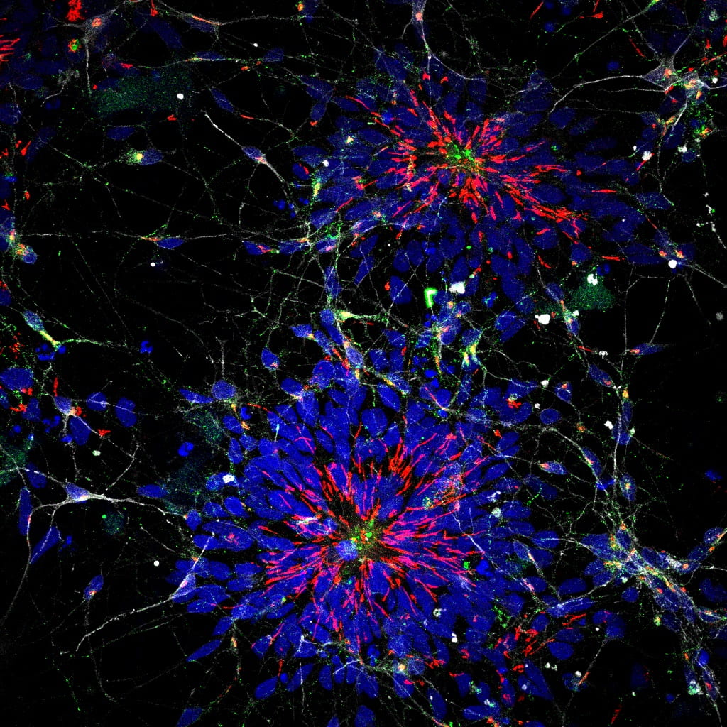 Art work by Miss Caroline Casey, Institute of Neurology. Handmade Neural Fireworks. Confocal microscopy UCL Doctoral School, Research Images as Art Competition entry 2017-2018..