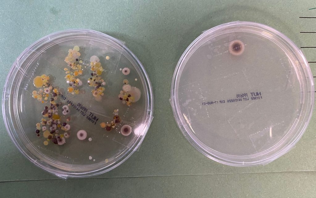 petri dishes with colonies